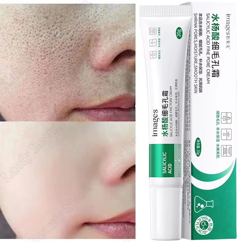 Salicylic Acid Blackhead Remover - Crema Purificante con Acido Salicilico, Riduce